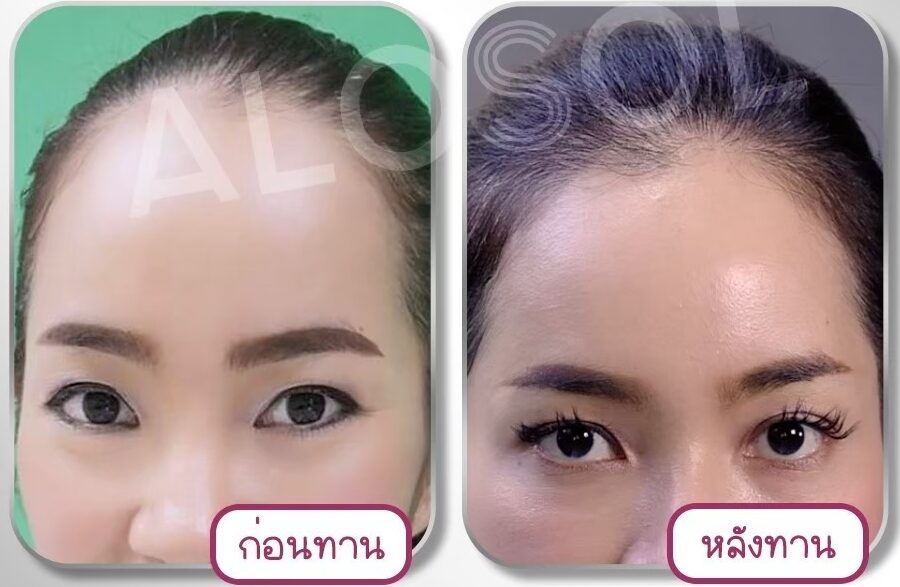 LINE_ALBUM_ALOSOL ริวิว (ภาพ)_241028_15 LINE_ALBUM_ALOSOL ริวิว (ภาพ)_241028_15