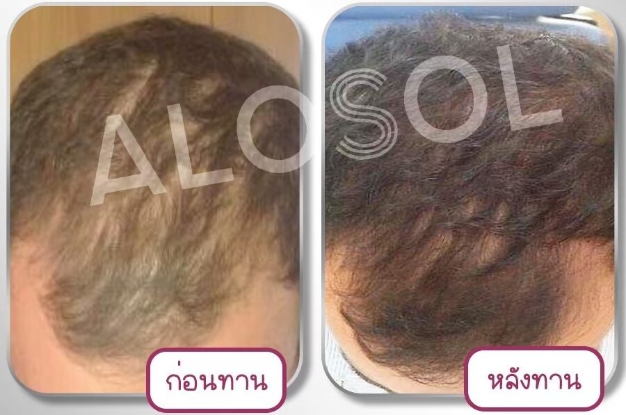 LINE_ALBUM_ALOSOL ริวิว (ภาพ)_241028_16 LINE_ALBUM_ALOSOL ริวิว (ภาพ)_241028_16