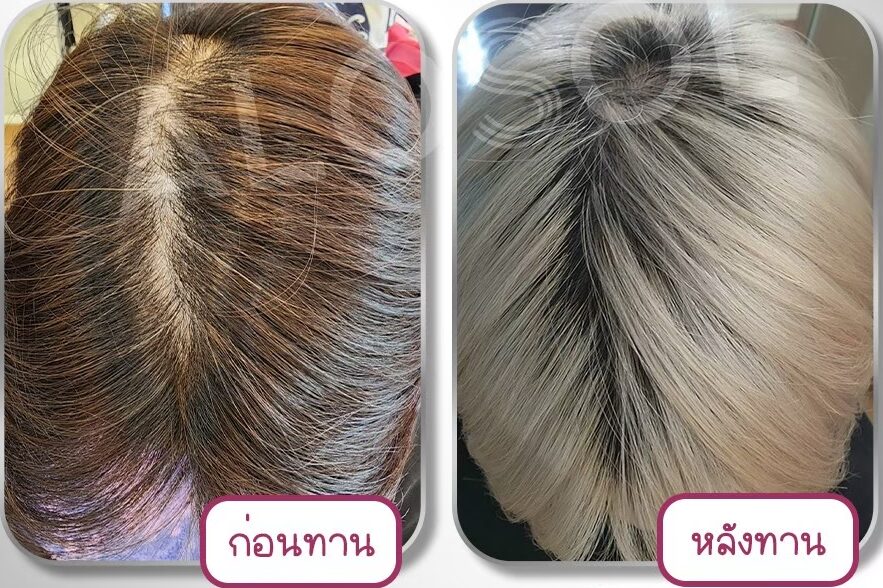 LINE_ALBUM_ALOSOL ริวิว (ภาพ)_241028_3 LINE_ALBUM_ALOSOL ริวิว (ภาพ)_241028_3