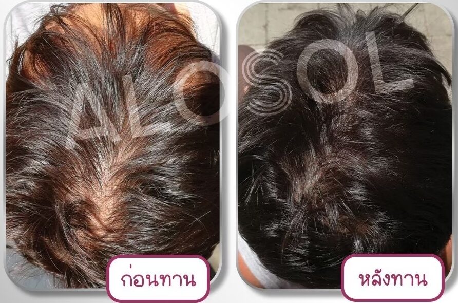 LINE_ALBUM_ALOSOL ริวิว (ภาพ)_241028_7 LINE_ALBUM_ALOSOL ริวิว (ภาพ)_241028_7