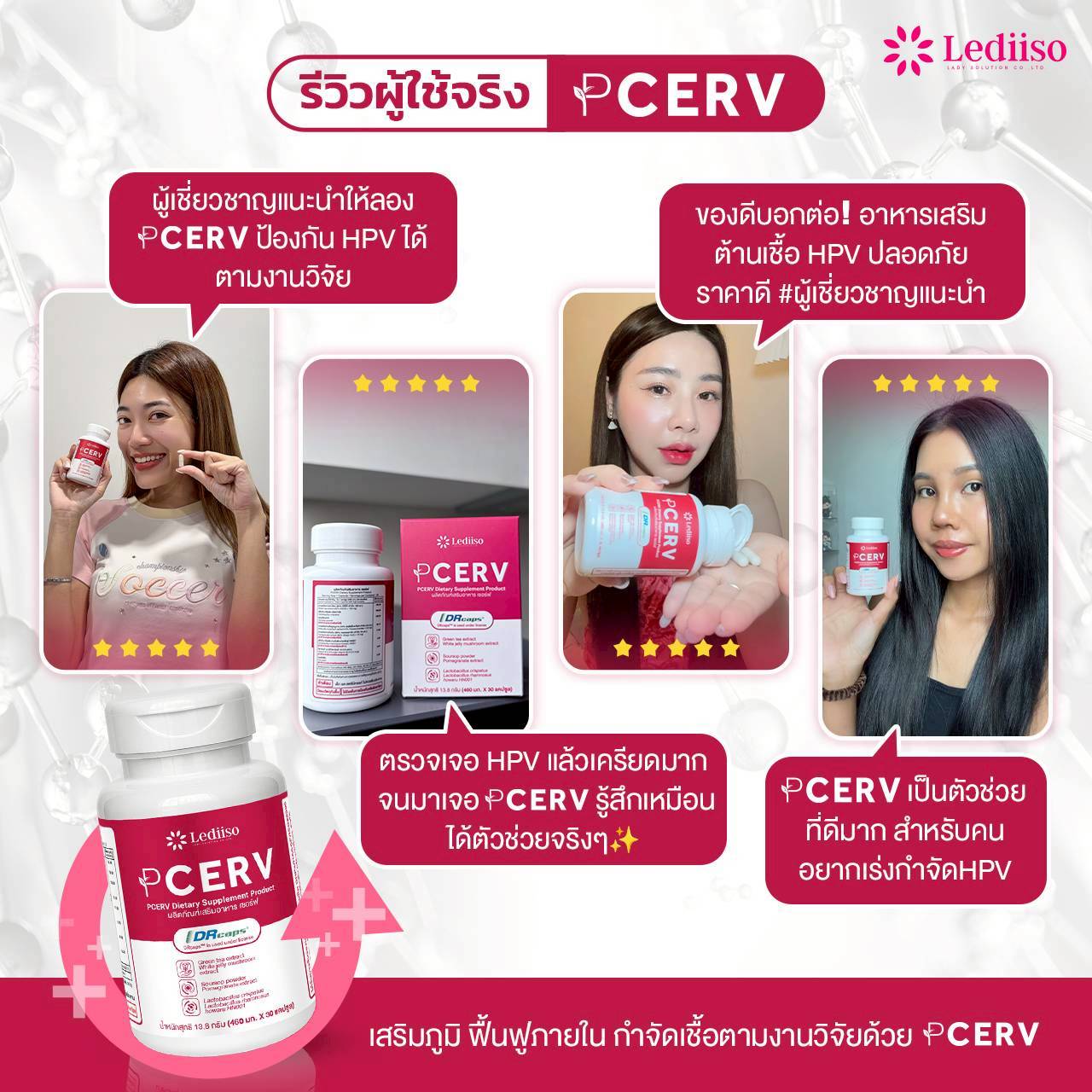 รีวิว PCERV 1