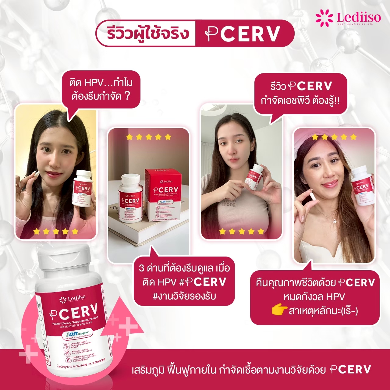 รีวิว PCERV 10