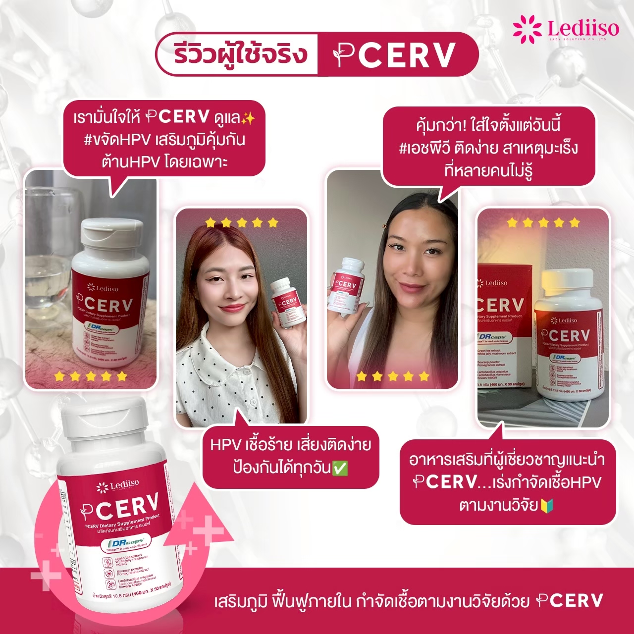 รีวิว PCERV 11