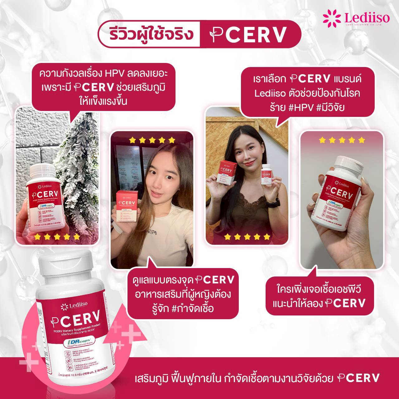 รีวิว PCERV 2