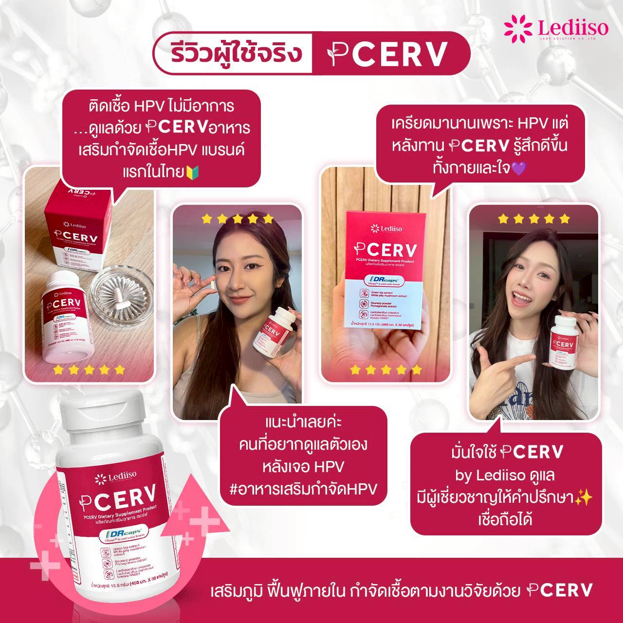 รีวิว PCERV 3