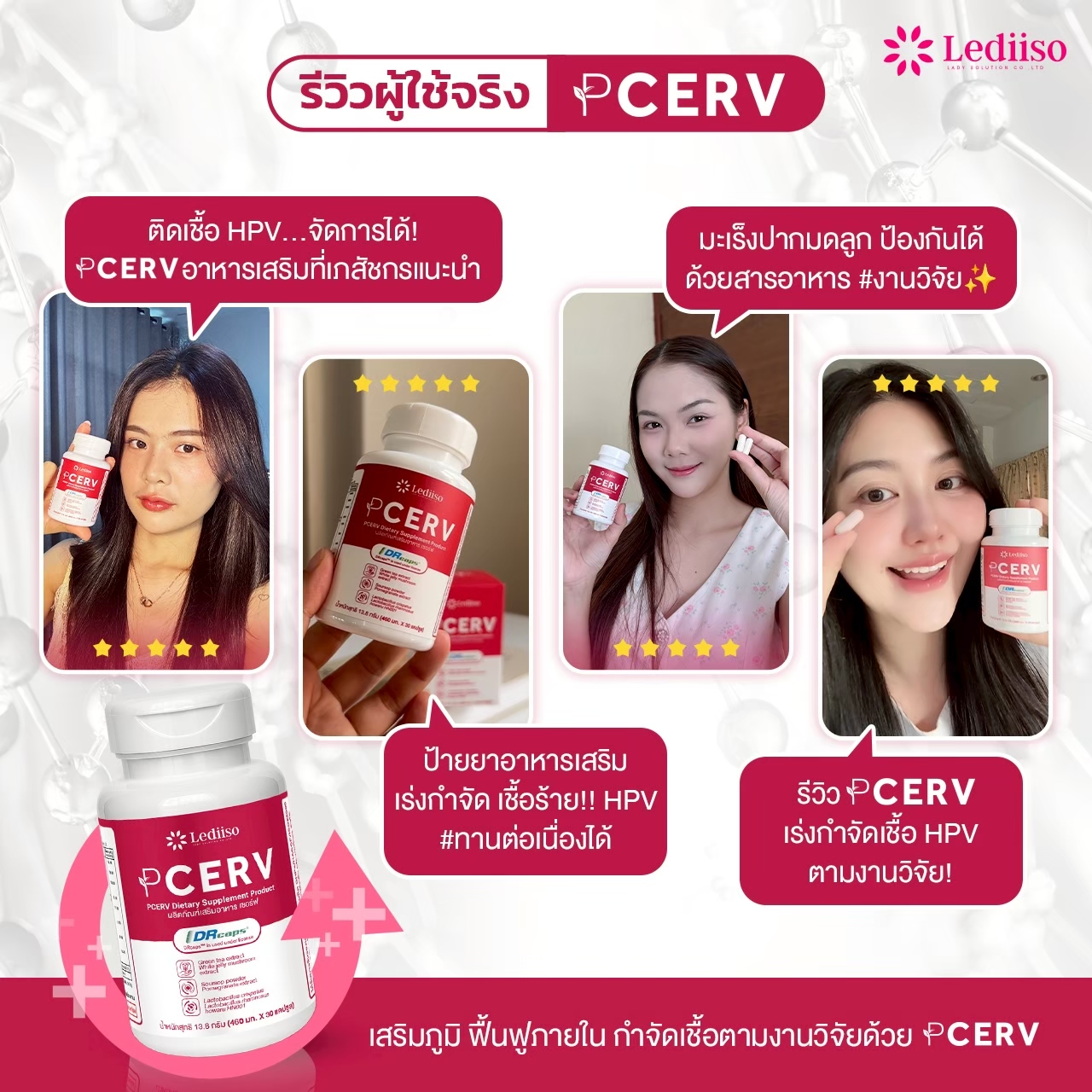 รีวิว PCERV 4