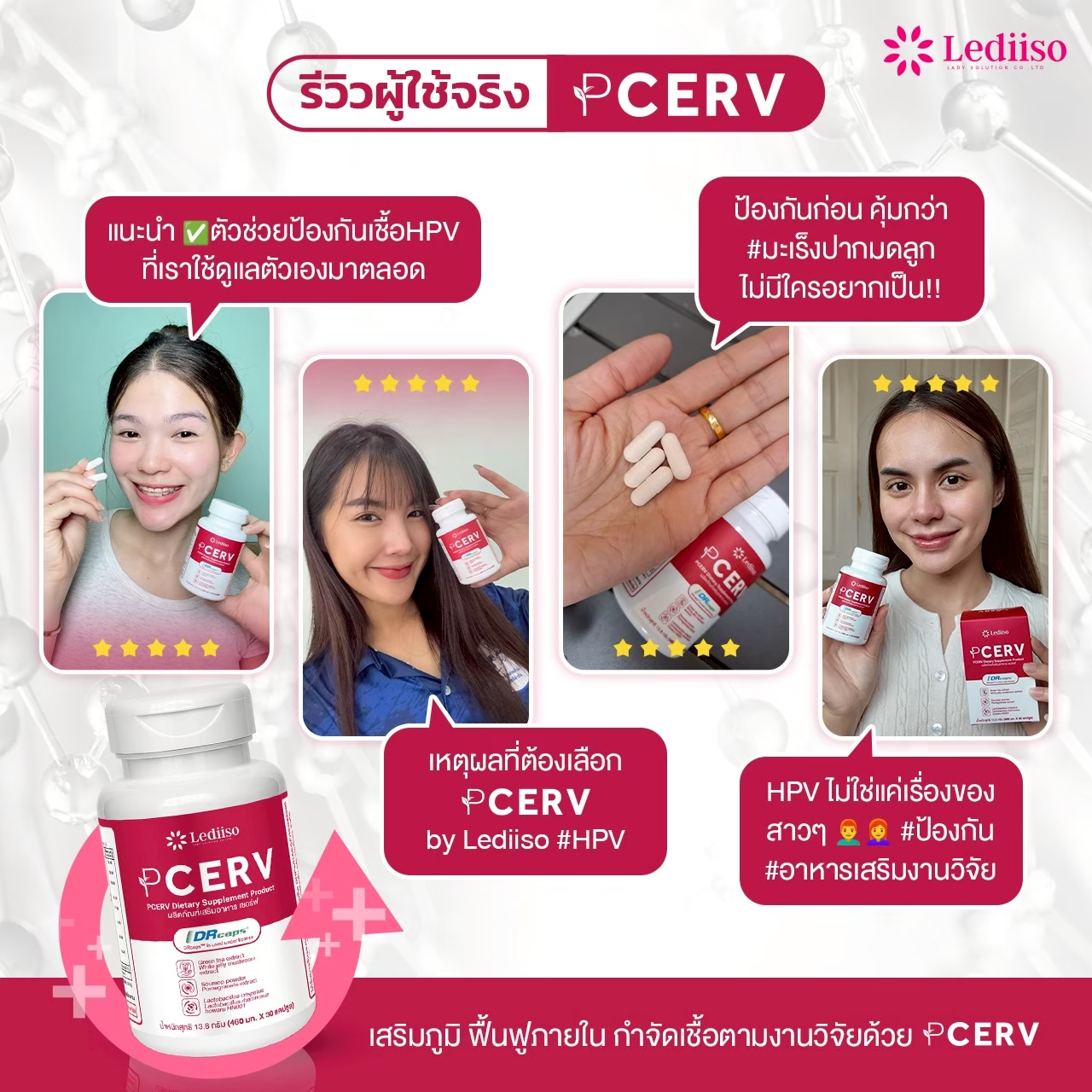 รีวิว PCERV 5
