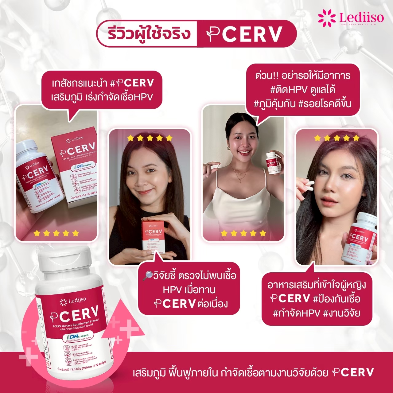 รีวิว PCERV 6