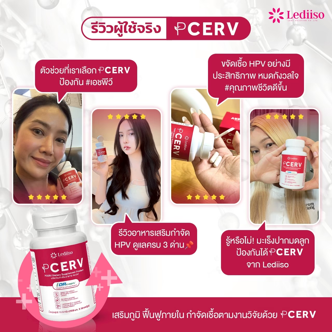 รีวิว PCERV 7