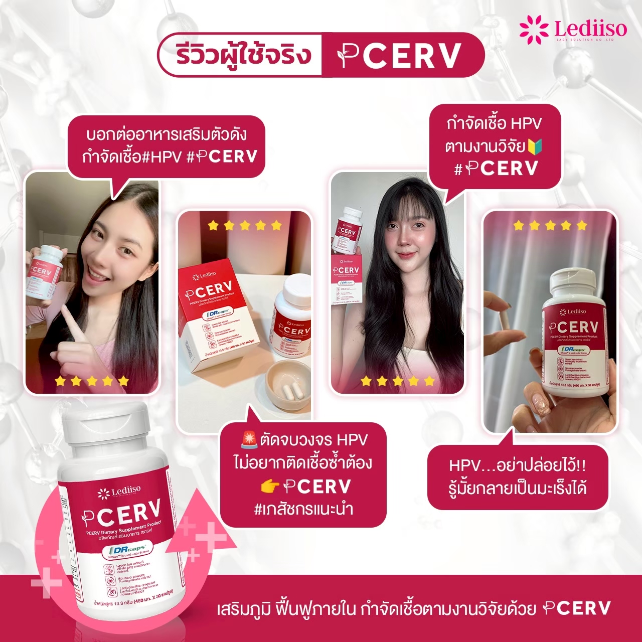 รีวิว PCERV 8