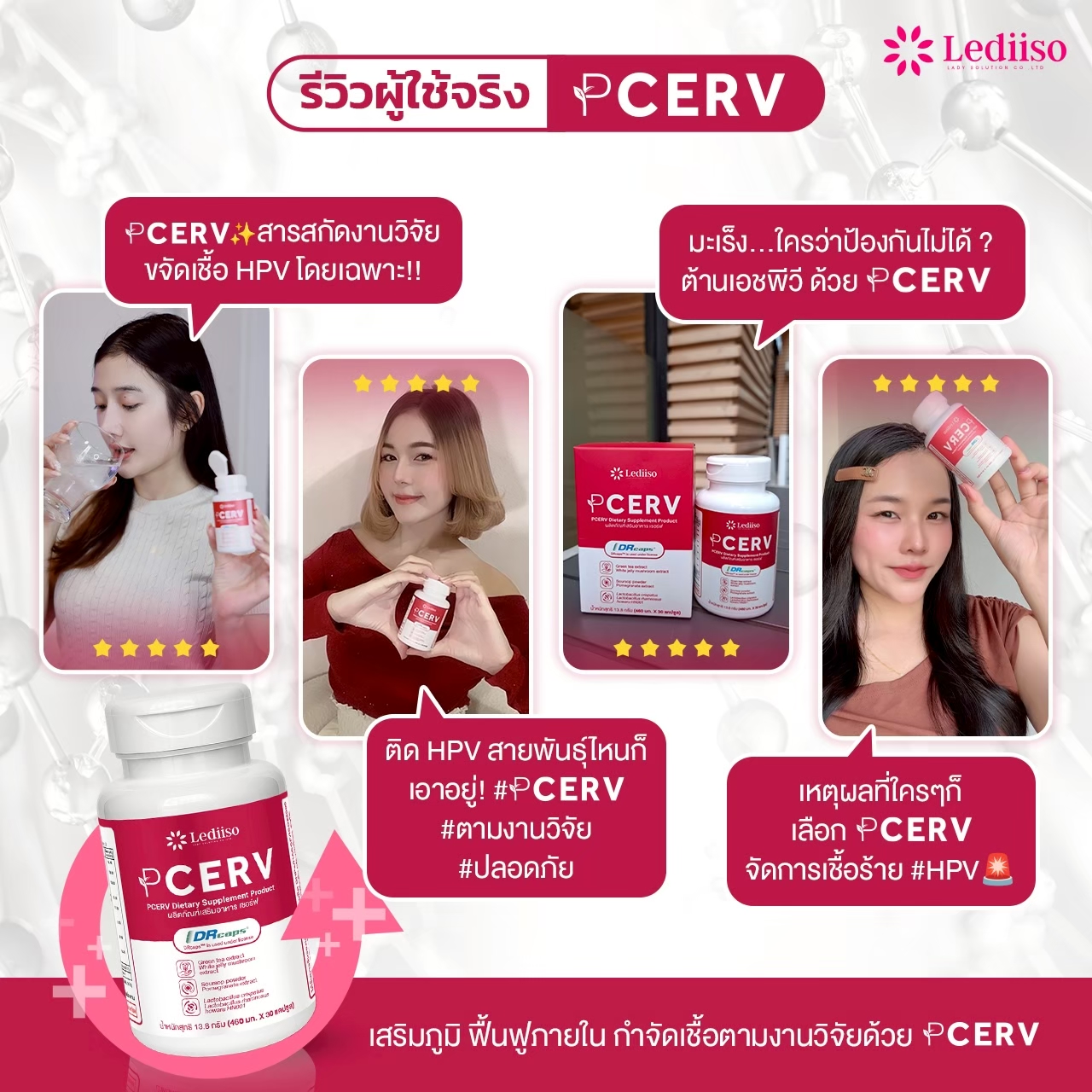 รีวิว PCERV 9