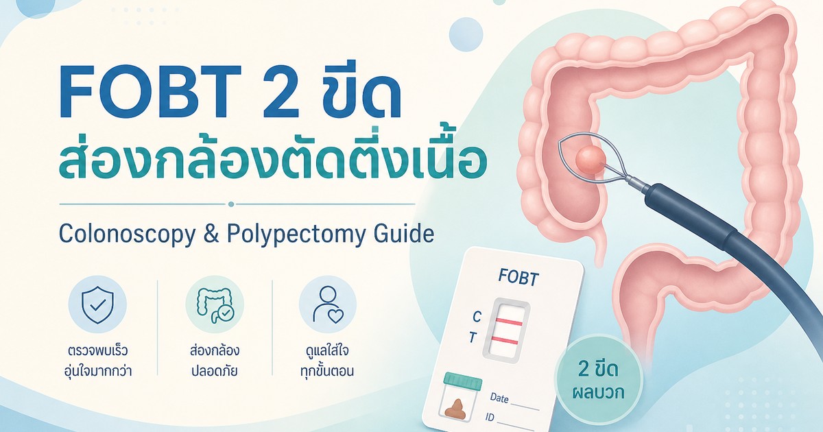 OG cover: FOBT polypectomy (English)